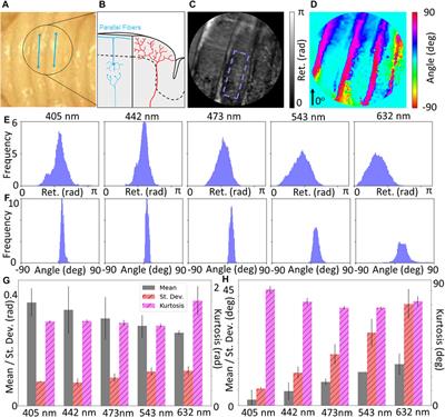 Backscattering Mueller Matrix polarimetry on whole brain specimens shows promise for minimally invasive mapping of microstructural orientation features